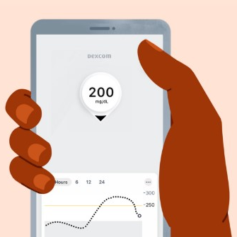 Czym różni się system CGM Dexcom od glukometru?